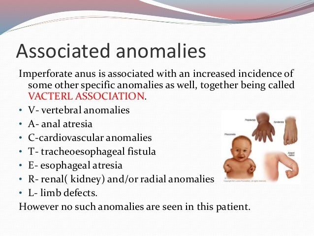 imperforate anus and associated defects Naked news vouyer